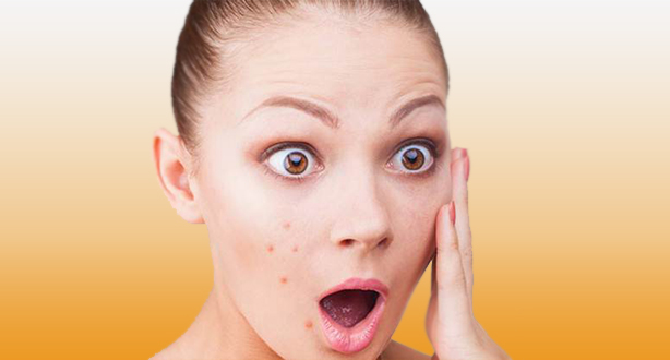 คลินิกนริทร์-พิลัมภา ความงามเหนือระดับที่ใครก็สั่งได้ บริการ Acne away เหมาะกับผู้ที่เป็นสิวปานกลาง